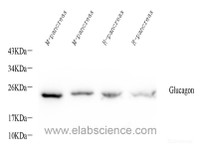 Western Blot analysis of various samples using GCG Polyclonal Antibody at dilution of 1:1000.