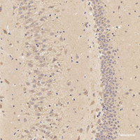 Immunohistochemistry analysis of paraffin-embedded rat Hippocampus using TAC1 Polyclonal Antibody at dilution of 1:300.