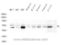 Western Blot analysis of various samples using P62/SQSTM1 Polyclonal Antibody at dilution of 1:1000.