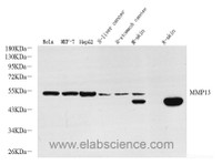 Western Blot analysis of various samples using MMP13 Polyclonal Antibody at dilution of 1:800.