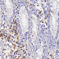 Immunohistochemistry analysis of paraffin-embedded rat colon using c-Kit Polyclonal Antibody at dilution of 1:200.