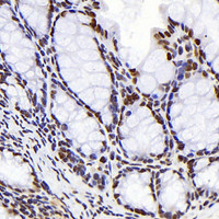 Immunohistochemistry analysis of paraffin-embedded mouse colon using S100A4 Monoclonal Antibody at dilution of 1:300.