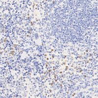 Immunohistochemistry analysis of paraffin-embedded mouse spleen using CCR5 Polyclonal Antibody at dilution of 1:300.