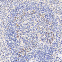 Immunohistochemistry analysis of paraffin-embedded rat spleen using CCR5 Polyclonal Antibody at dilution of 1:300.