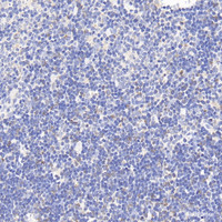 Immunohistochemistry analysis of paraffin-embedded rat thymus using CCR5 Polyclonal Antibody at dilution of 1:300.