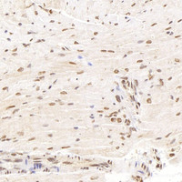 Immunohistochemistry analysis of paraffin-embedded mouse heart using SMAD2 Polyclonal Antibody at dilution of 1:400.