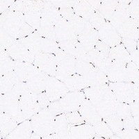 Immunohistochemistry analysis of paraffin-embedded rat skeletal muscle using SMAD2 Polyclonal Antibody at dilution of 1:400.