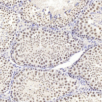 Immunohistochemistry analysis of paraffin-embedded mouse testis using SIRT1 Polyclonal Antibody at dilution of 1:300.