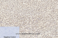 Immunohistochemistry of paraffin-embedded Human uterus tissue using Histone H3 Monoclonal Antibody at dilution of 1:200.