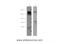 Western Blot analysis of 1) Hela, 2) Mouse brain using ERBB2 Monoclonal Antibody at dilution of 1:4000.