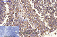 Immunohistochemistry of paraffin-embedded Human tonsil tissue using ERBB2 Monoclonal Antibody at dilution of 1:200.