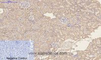 Immunohistochemistry of paraffin-embedded Rat kidney tissue using CD23 Monoclonal Antibody at dilution of 1:200.
