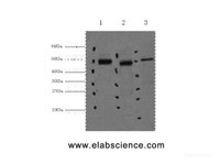 Western Blot analysis of 1) Hela, 2) Mouse kidney, 3) Mouse brain using CK-7 Monoclonal Antibody at dilution of 1:2000.