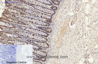 Immunohistochemistry of paraffin-embedded Human colon tissue using CK-8 Monoclonal Antibody at dilution of 1:200.
