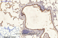 Immunohistochemistry of paraffin-embedded Rat lung tissue using CK-16 Monoclonal Antibody at dilution of 1:200.