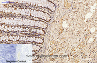 Immunohistochemistry of paraffin-embedded Human colon tissue using CDX2 Monoclonal Antibody at dilution of 1:200.