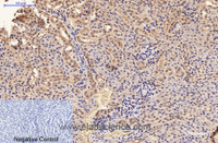 Immunohistochemistry of paraffin-embedded Mouse kidney tissue using GFAP Monoclonal Antibody at dilution of 1:200.