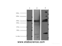 Western Blot analysis of 1) Hela, 2) Mouse heart, 3) Rat heart using AQP4 Monoclonal Antibody at dilution of 1:2000.
