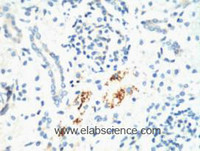 Immunohistochemistry of paraffin-embedded Mouse kidney tissue using KIF7 Monoclonal Antibody at dilution of 1:200.