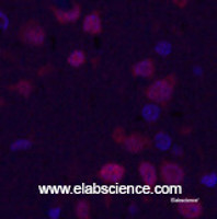 Immunofluorescence analysis of Rat brain tissue using KI67 Monoclonal Antibody at dilution of 1:200.