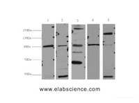 Western Blot analysis of 1) Hela, 2) 293T, 3) MCF7, 4) Mouse brain, 5) Rat liver using Catenin beta Monoclonal Antibody at dilution of 1:2000.