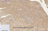 Immunohistochemistry of paraffin-embedded Mouse heart tissue using ENO2 Monoclonal Antibody at dilution of 1:200.