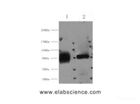 Western Blot analysis of 1) Hela, 2) 293T cells using ABCB5 Monoclonal Antibody at dilution of 1:2000.