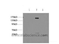 Western Blot analysis of 1) Hela, 2) 293, 3) Jurkat cells using ERBB2 Monoclonal Antibody at dilution of 1:2000.