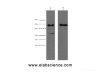 Western Blot analysis of 1) Hela, 2) HepG2 cells using CK-6A/B/C Monoclonal Antibody at dilution of 1:2000.