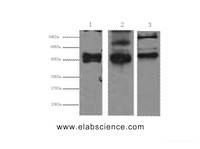 Western Blot analysis of 1) Hela, 2) MCF7, 3) 293T cells using CK-17 Monoclonal Antibody at dilution of 1:2000.