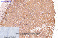 Immunohistochemistry of paraffin-embedded Human liver tissue using CK-17 Monoclonal Antibody at dilution of 1:200.