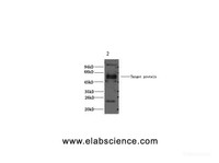 Western Blot analysis of 1) Hela, 2) Mouse brain using CD23 Monoclonal Antibody at dilution of 1:2000.