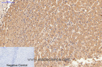 Immunohistochemistry of paraffin-embedded Human liver tissue using alpha Lactalbumin Monoclonal Antibody at dilution of 1:200.