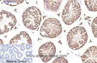 Immunohistochemistry of paraffin-embedded Mouse testis tissue using EFHD1 Monoclonal Antibody at dilution of 1:200.