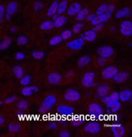 Immunofluorescence analysis of Human liver cancer tissue using XRCC4 Monoclonal Antibody at dilution of 1:200.