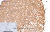 Immunohistochemistry of paraffin-embedded Human liver tissue using CD16 Monoclonal Antibody at dilution of 1:200.
