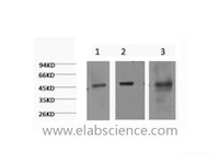 Western Blot analysis of 1) Hela, 2) HepG2, 3) Mouse skeletal muscle using CK-18 Monoclonal Antibody at dilution of 1:1000.