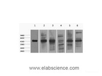 Western Blot analysis of 1) HepG2, 2) Hela, 3) Mouse Liver tissue, 4) C2C12, 5) Rat Heart tissue, 6) Mouse Skeletal Muscle tissue, (8F2 using CK-18 Monoclonal Antibody at dilution of 1:2000.