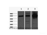 Western Blot analysis of 1) Hela, 2) Rat heart, 3) Mouse spleen using NFκB-p65 Monoclonal Antibody at dilution of 1:2000.