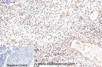 Immunohistochemistry of paraffin-embedded Human appendix tissue using NFκB-p65 Monoclonal Antibody at dilution of 1:200.