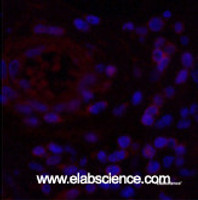 Immunofluorescence analysis of Human appendix tissue using NFκB-p65 Monoclonal Antibody at dilution of 1:200.