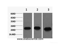 Western Blot analysis of 1) MCF7, 2) Rat kidney, 3) Mouse brain using PRDX1 Monoclonal Antibody at dilution of 1:2000.