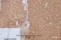 Immunohistochemistry of paraffin-embedded Human liver tissue using COL3A1 Monoclonal Antibody at dilution of 1:200.