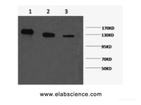 Western Blot analysis of 1) Hela, 2) 293T, 3) Jurkat cells using PARP1 Monoclonal Antibody at dilution of 1:2000.