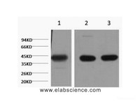 Western Blot analysis of 1) Hela, 2) Mouse brain, 3) Rat brain using ACTA1 Monoclonal Antibody at dilution of 1:1000.