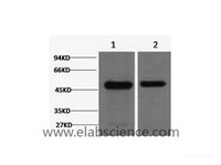Western Blot analysis of 1) Mouse brain, 2) Rat brain using FN1 Monoclonal Antibody at dilution of 1:2000.