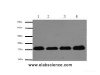 Western Blot analysis of Hela, Rat brain, NIH, 3T3, 293T using Proliferating Cell Nuclear Antigen Monoclonal Antibody at dilution of 1:5000.