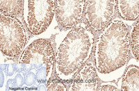 Immunohistochemistry of paraffin-embedded Rat testis tissue using Proliferating Cell Nuclear Antigen Monoclonal Antibody at dilution of 1:200.