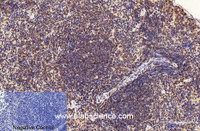 Immunohistochemistry of paraffin-embedded Mouse spleen tissue using CD2 Monoclonal Antibody at dilution of 1:200.