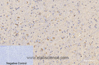 Immunohistochemistry of paraffin-embedded Mouse brain tissue using CD4 Monoclonal Antibody at dilution of 1:200.